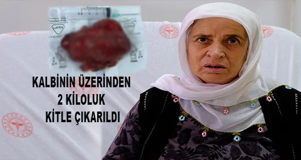 Kalbinin Üzerinden 2 Kiloluk Kitle Çıkarıldı